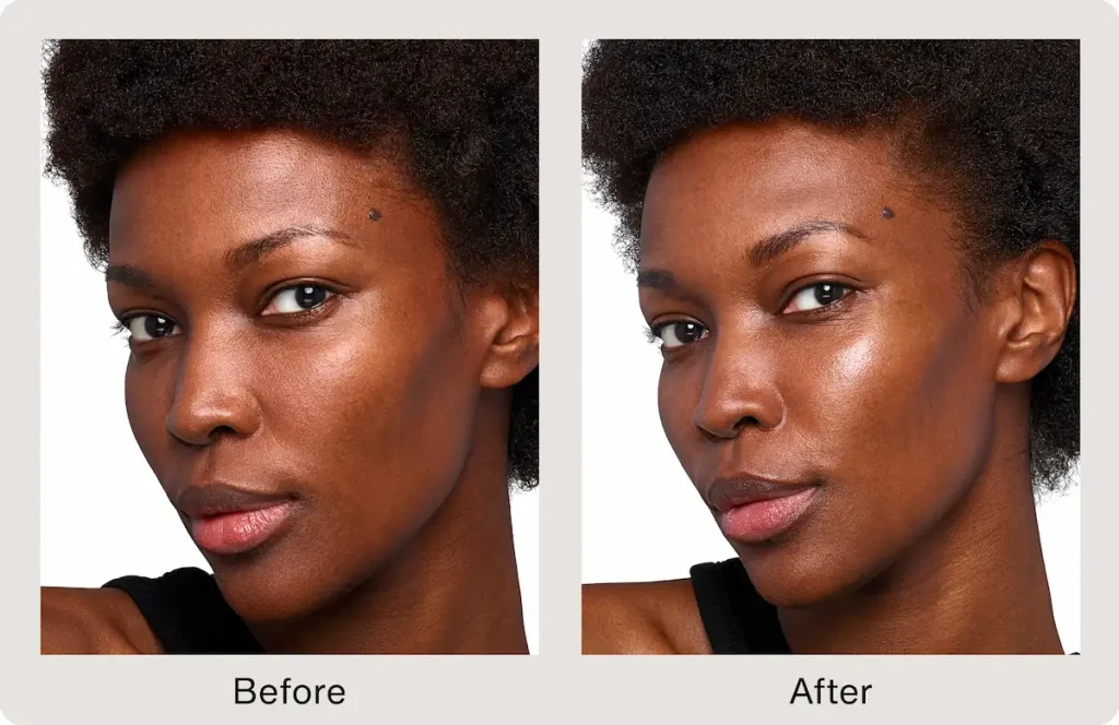 Before and after skinvive